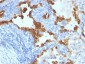  Cytokeratin 8/18 Antibody - With BSA and Azide