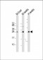 CDX1 Antibody (C-term)