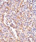 PPP2R1B Antibody