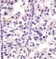 CDK4 Antibody