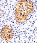 RAB3B Antibody