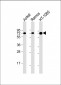 GARS Antibody