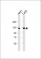 CADH1 Antibody