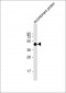 FAT1 Antibody