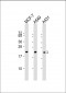 RAB13 Antibody