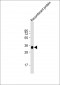 LRP1B Antibody