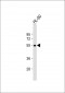 MCHR1 Antibody (C-term)