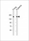 CFH Antibody (Center)