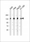 CD130 Antibody (C-term)