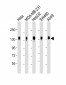 CD130 Antibody (C-term)