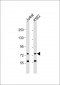 ATG16L2 Antibody (Center K292)