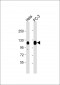 TRIM28 Antibody (N-term)