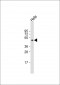 MeCP2 Antibody (N-term S80)