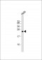 IL17B Antibody (Center)