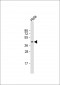 NUDT9 Antibody (C-term)