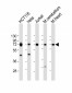 TCF7L2 Antibody (N-term)