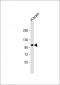 ANKRD6 Antibody (Center)