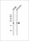 FGF11 Antibody (N-term)