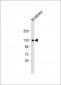 CACNA2D2 Antibody (Center)