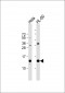 PHF5A Antibody (C-term)