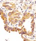SFTPC Antibody (C-term)