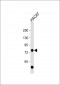 TP63 Antibody (C-term)