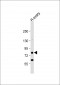 DDX4 Antibody (C-term)