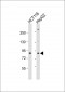 K Cadherin (CDH6) Antibody (N-term)