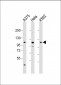 IDE Antibody (Center)