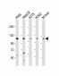 IDE Antibody (Center)