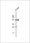 ALDH5A1 Antibody (N-term)