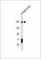 L1CAM Antibody (C-term)