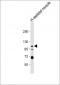 KCNQ5 Antibody (C-term)