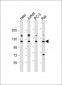 REST Antibody (Center)