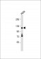 HIRA Antibody (N-term)