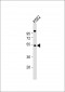 EIF2B3 Antibody (C-term)