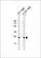 ULBP2 Antibody (Center)