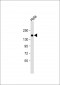 BRCA1 Antibody (N-term)