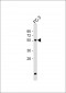 GPNMB Antibody (C-term)