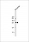 SOST Antibody (N-term)