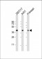 ERLIN2 Antibody (C-term)