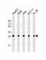 PMM2 Antibody (C-term)