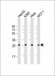 PMM2 Antibody (C-term)