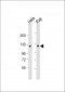 NFKB(p100) Antibody (C-term S866/870)