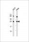 PSPH Antibody (N-term)