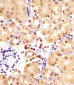 (Mouse) Ihh Antibody (N-term)