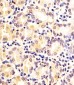 FN3KRP Antibody (N-Term)