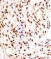 HNRNPA1L2 Antibody (N-Term)