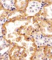 SLC22A2 Antibody (N-term)