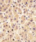 PYGL Antibody (C-Term)